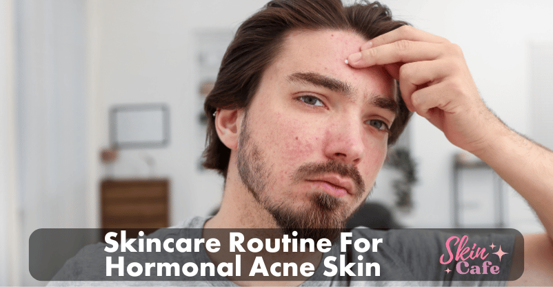 Skincare Routine For Hormonal Acne Skin