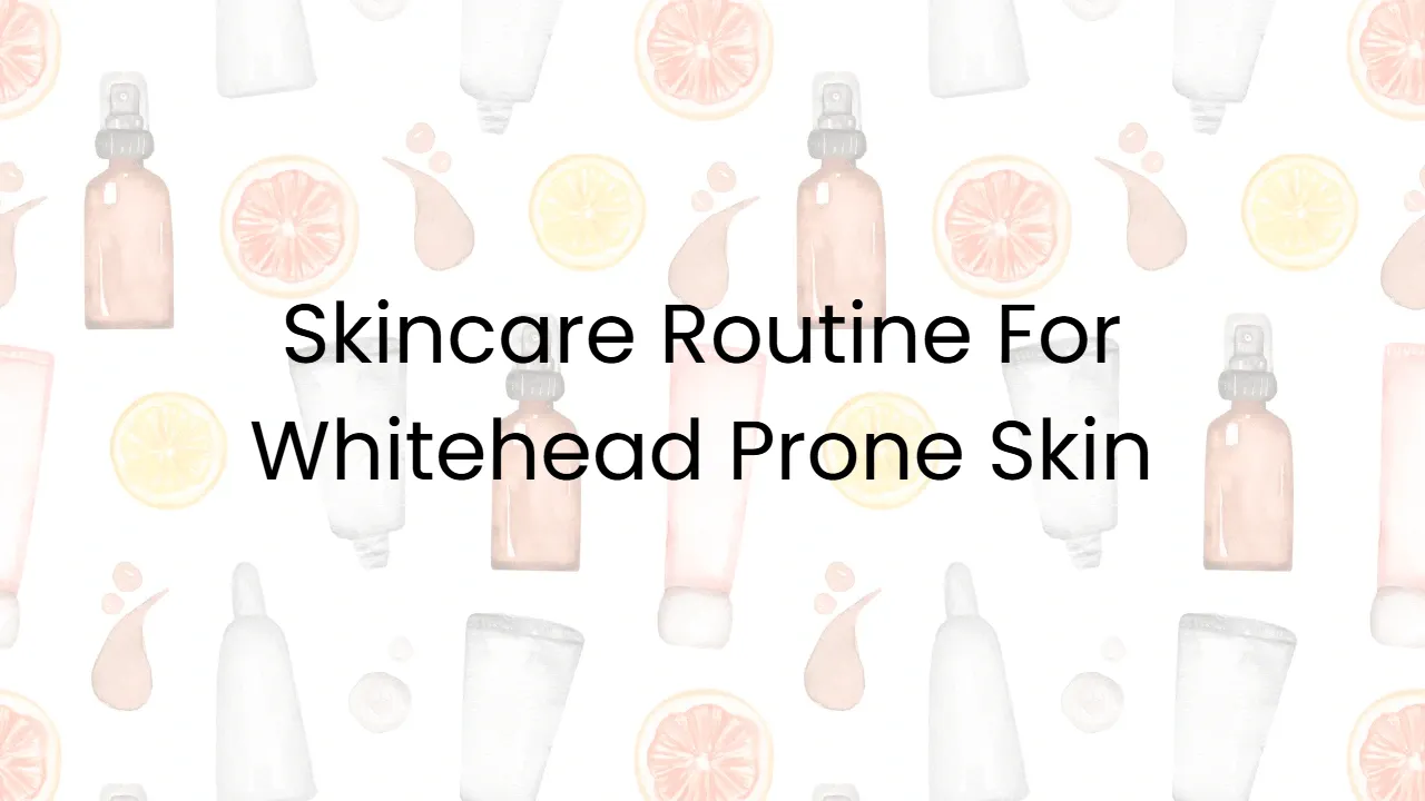 Skincare Routine For Whitehead Prone Skin